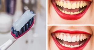 10 روش برای سفید کردن طبیعی دندان های زرد در خانه