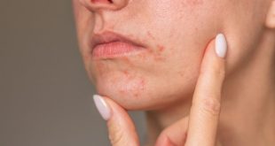 چطور بفهمیم یک محصول پوستی باعث حساسیت نمی‌شود؟
